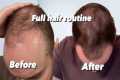 The Hair routine that saved my hair…