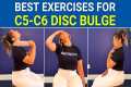 Best Exercises for C5-C6 Disc Bulge