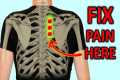 Rhomboid Pain: How To Fix Shoulder