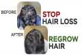 How To Stop Hair Loss & Regrow