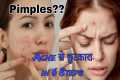 How To Remove Pimples | How To Get