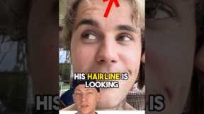 Justin Bieber’s NEW HAIR | Surgeon Analysis