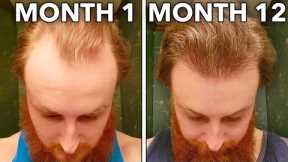 How To Reverse Hair Loss In 12 Months