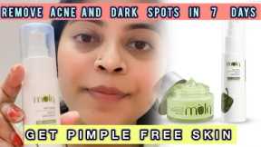 Plum Green Tea Oil Free Moisturiser | oil and acne prone skin #acne #moisturizer