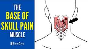 The Base of the Skull Pain Muscle (How to Release It for INSTANT RELIEF)