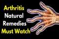 5 Best Arthritis Natural Remedies You 