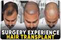 Hair Transplant in Palanpur | Best