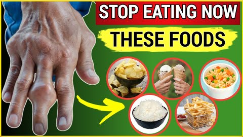 6 Most Dangerous Foods (Don’t Eat If You Have Arthritis)