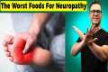 The Worst Foods For Neuropathy (Best