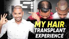 Hair Transplant in Jodhpur | Best Results & Cost of Hair Transplant in Jodhpur