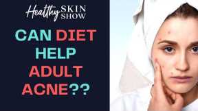 Can FOOD Help Adult ACNE? | Brie Wieselman