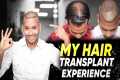 Hair Transplant in Jodhpur | Best