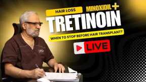 Tretinoin for hair loss and when to STOP before your Hair Transplant