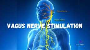 Vagus Nerve Stimulation