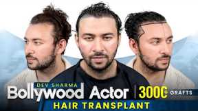 Bollywood Star's Secret Revealed: Dev Sharma's Hair Transplant! #hairtransplant