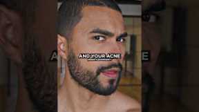 Jose Zuniga on How To Get Rid Off Pimple