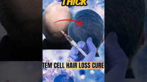 Stem Cell Hair Loss Cure?