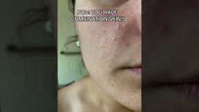 Do you have COMBINATION SKIN?! #skincare #skincareroutine