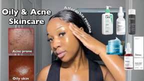 SKINCARE ROUTINE FOR OILY ACNE-PRONE SKIN | A routine for smooth & clear Skin ‼️