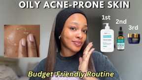 A simple oily acne-prone skincare routine | For smoother & clearer skin