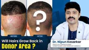 Donor Area Recovery: Will Hair Regrow After My Hair Transplant? Dr. Nipun Answers #hairtransplant