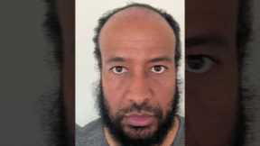 1 Year Afro Hair Transplant Turkey Results #shorts #hairtransplant #hairtransplantturkey