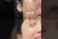 1 PRODUCT Changed ACNE TO CLEAR SKIN