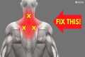 How to INSTANTLY Fix Neck and Upper