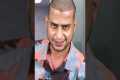 YouTuber Mehtab Saifi Hair Transplant 