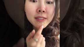 satisfying hydrocolloid patch removal HAHA #acne #oilyskin #skincare