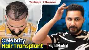 Sajid Shaikh's Hair Transformation Journey with Hairfree & Hairgrow | Real Testimonial