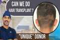 Hair Transplant In Chennai | Best