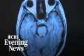 Researcher says Long COVID causing