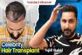 Sajid Shaikh's Hair Transformation