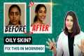AM Skincare routine for oily acne