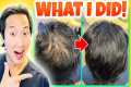 How I Treated My Thinning Hair the