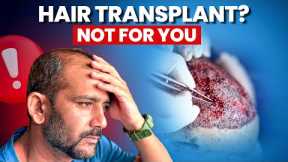 Stop! Don’t Get a Hair Transplant Until You See This