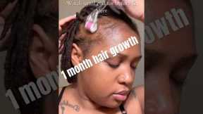 1 month Hair growth journey! #minoxidil #hairgrowth #hairgrowthchallange #baldinghair #hairloss