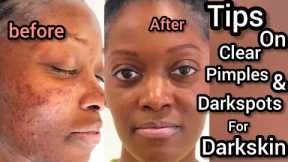 Clear pimples and darkspots With My morning and night simple skincare routine !