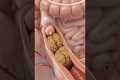 Illustration of Constipation Moving | 