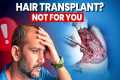 Stop! Don’t Get a Hair Transplant