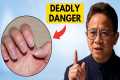13 Hidden Signs Your Body Lacks