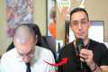 Turkey Hair Transplant: 1-Year