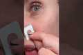 How An Esthetician Gets Rid Of A