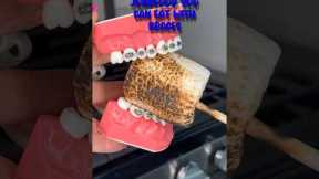 JUNKFOOD YOU CAN EAT WITHOUT BREAKING BRACES OFF 👀 ORTHODONTIST REACTS TO UNHEALTHY SNACKS 🦷