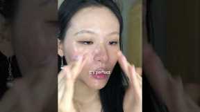 Closed Comedones Treatment #koreanskincare