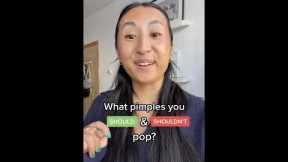 What pimples you SHOULD and SHOULDN’T pop?