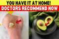 Stop Eating the Wrong Fruits – These