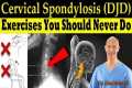 Cervical Spondylosis (DJD) Exercises