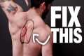 How to Fix Upper Back Pain (NO MORE